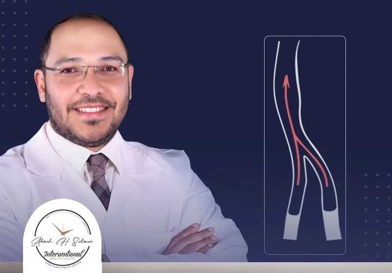 دكتور-دوالي-الساقين