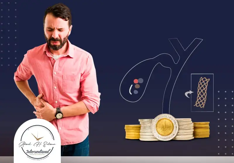 سعر-الدعامة-المعدنية-للقناة-المرارية