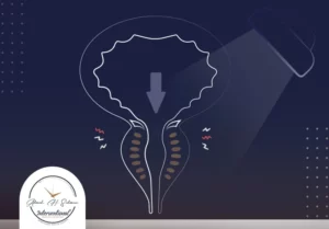 علاج-تضخم-البروستاتا-بالأشعة-التداخلية-1